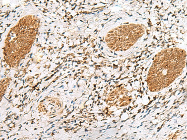 NUP58 Polyclonal Antibody (E-AB-52764)