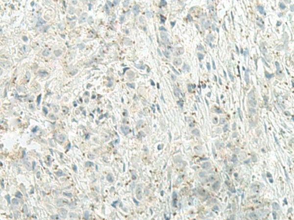 UQCC2 Polyclonal Antibody (E-AB-52684)