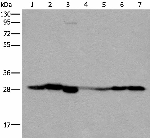 VTI1B Polyclonal Antibody (E-AB-52425)