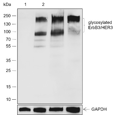 Recombinant ErbB3/HER3 Monoclonal Antibody (AN301827L)