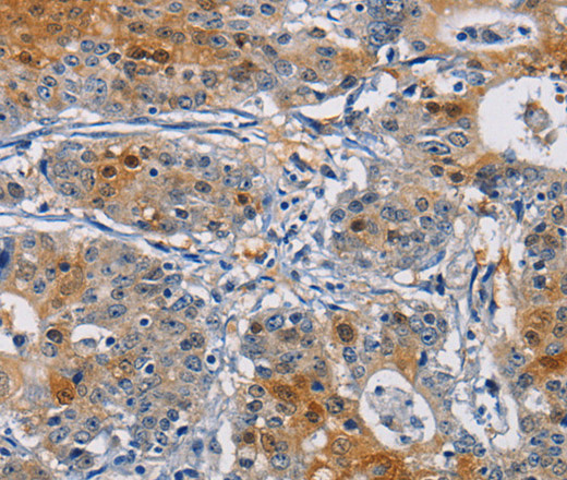 GSTA2 Polyclonal Antibody (E-AB-14719)