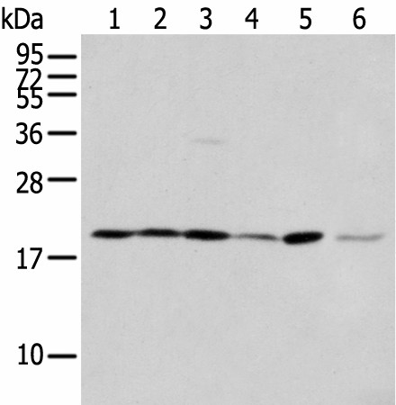 EEF1E1 Polyclonal Antibody (E-AB-18404)