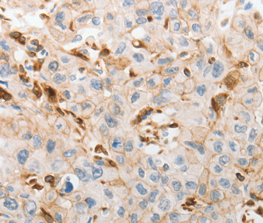 SLC15A2 Polyclonal Antibody (E-AB-15825)