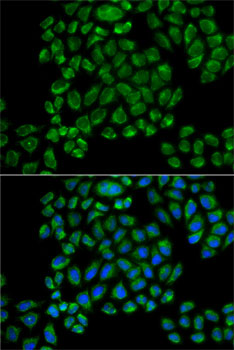 GRIA3 Polyclonal Antibody (E-AB-66190)