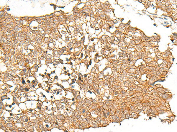 PRLHR Polyclonal Antibody (E-AB-19927)