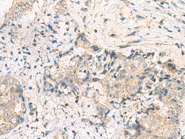 MGAT4B Polyclonal Antibody (E-AB-19215)