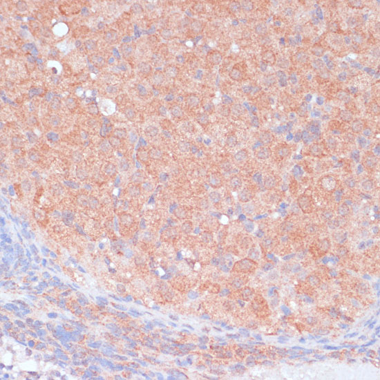 LRP1 Polyclonal Antibody (E-AB-66274)