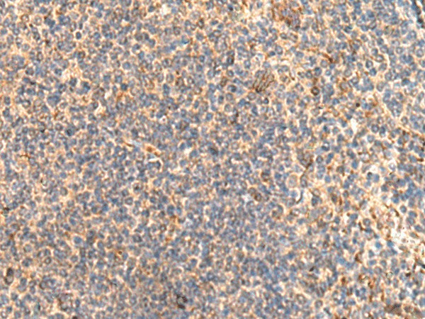 ABHD2 Polyclonal Antibody (E-AB-19433)