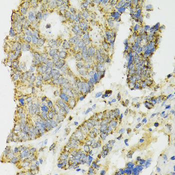 IDH2 Polyclonal Antibody (E-AB-61574)