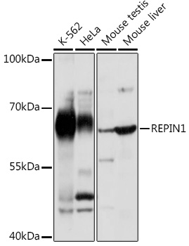 REPIN1 Polyclonal Antibody (E-AB-92052)