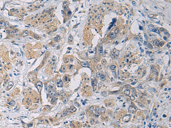 CYTIP Polyclonal Antibody (E-AB-19252)