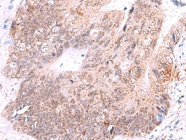 ASTN2 Polyclonal Antibody (E-AB-52954)