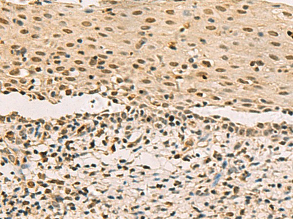 LRIF1 Polyclonal Antibody (E-AB-18561)