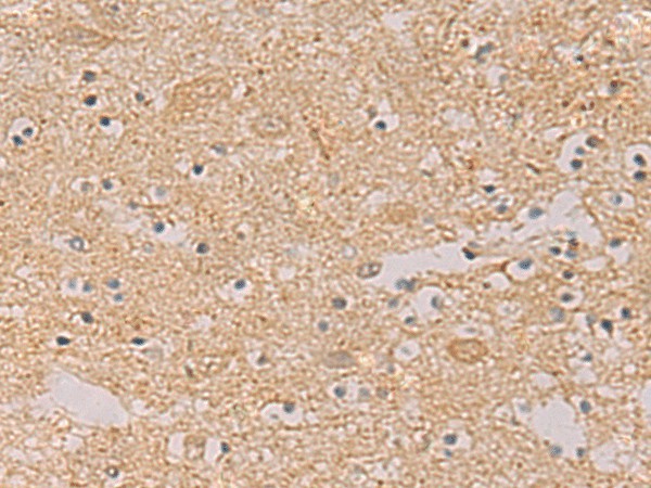 PTPRN Polyclonal Antibody (E-AB-52202)