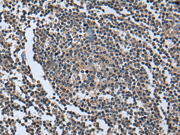 WNT9B Polyclonal Antibody (E-AB-19587)