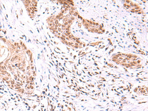TRMT12 Polyclonal Antibody (E-AB-19045)