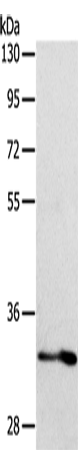ST2 Polyclonal Antibody (E-AB-10683)