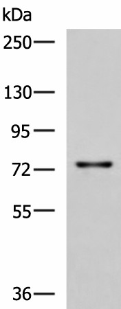 TGFBI Polyclonal Antibody (E-AB-18249)