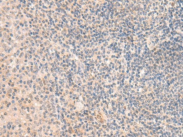 GRM2 Polyclonal Antibody (E-AB-19414)