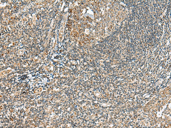 MOB2 Polyclonal Antibody (E-AB-19976)