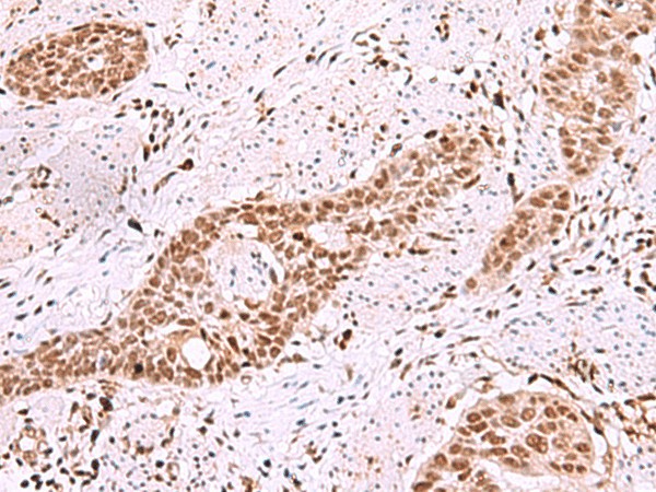ISL2 Polyclonal Antibody (E-AB-18132)
