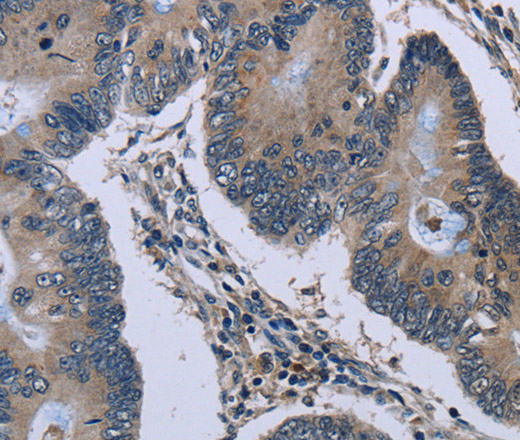 Connexin 47 Polyclonal Antibody (E-AB-12341)