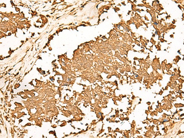 PWP1 Polyclonal Antibody (E-AB-18842)