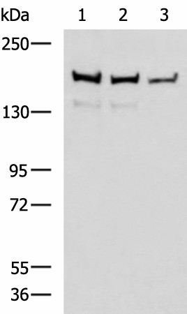 ROCK2 Polyclonal Antibody (E-AB-52117)