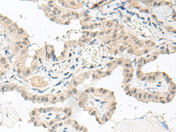 GFI1B Polyclonal Antibody (E-AB-17998)