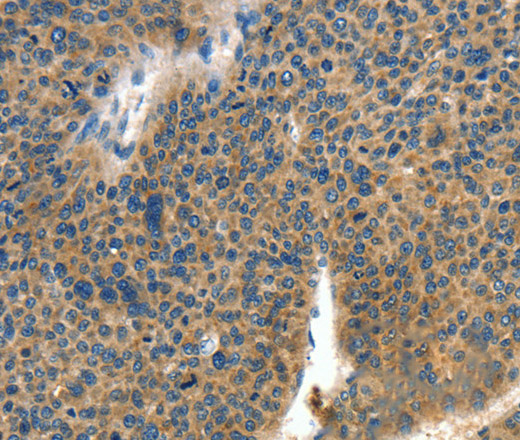COL4A2 Polyclonal Antibody (E-AB-13160)