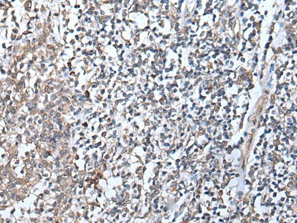 DEFB104A Polyclonal Antibody (E-AB-53371)