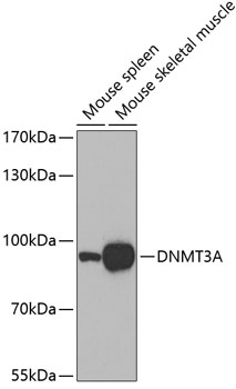 DNMT3A Polyclonal Antibody (E-AB-68361)