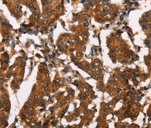 ATRN Polyclonal Antibody (E-AB-16269)