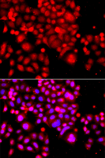 ASCC3 Polyclonal Antibody (E-AB-62369)