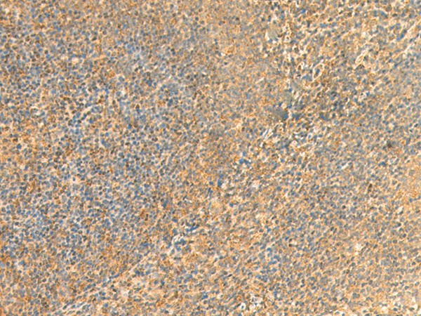 UBD Polyclonal Antibody (E-AB-18910)