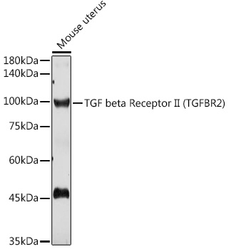 TGFBR2 Polyclonal Antibody (E-AB-65842)