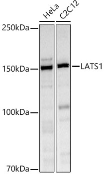 LATS1 Polyclonal Antibody (E-AB-93222)