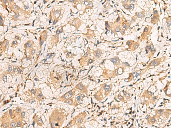 TNNT1 Polyclonal Antibody (E-AB-19204)