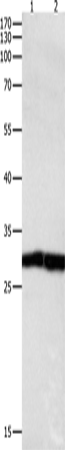 MKP-3 Polyclonal Antibody (E-AB-10308)