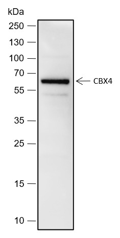 Recombinant CBX4 Monoclonal Antibody (AN301815L)