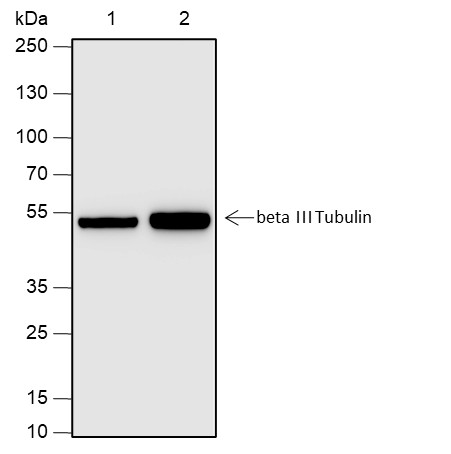 Recombinant beta III Tubulin Monoclonal Antibody (AN301935L)