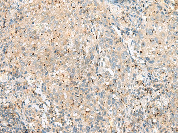 EIF3L Polyclonal Antibody (E-AB-52762)
