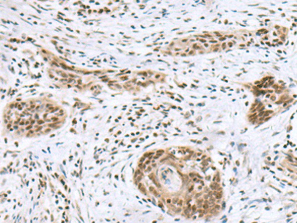 INSM1 Polyclonal Antibody (E-AB-52027)