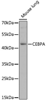 CEBPA Polyclonal Antibody (E-AB-64040)