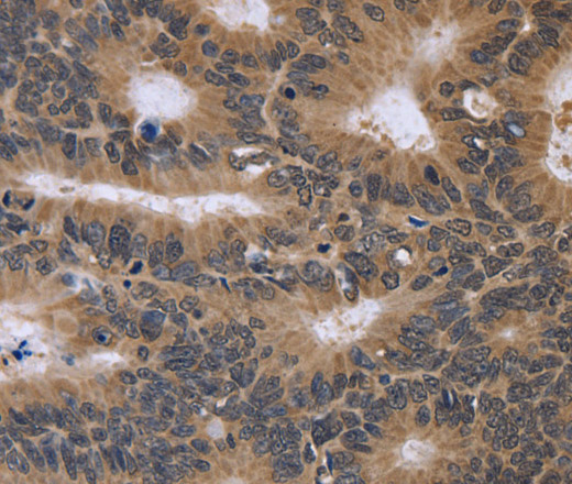 FGFR1OP2 Polyclonal Antibody (E-AB-11233)