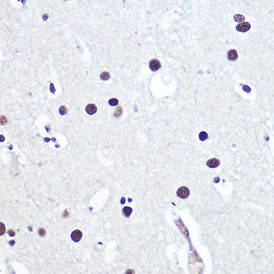 TP53BP1 Polyclonal Antibody (E-AB-92405)