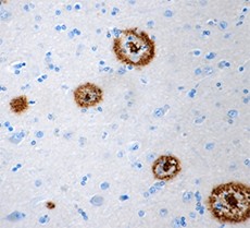 Purified anti-β-Amyloid, 1-11 Antibody (835104)