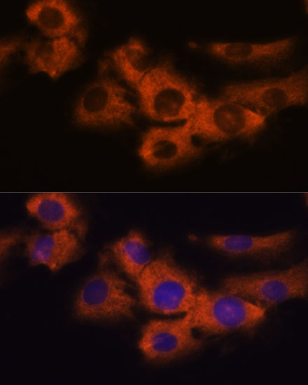 NDRG4 Polyclonal Antibody (E-AB-66719)