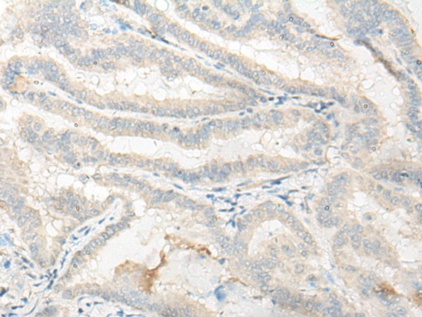 DNASE1L1 Polyclonal Antibody (E-AB-52599)