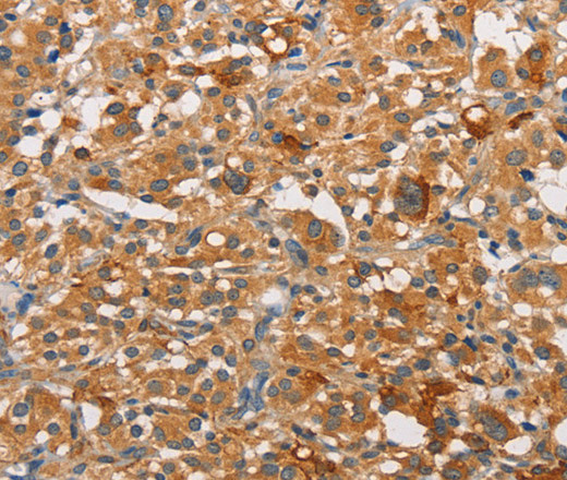 PKC epsilon Polyclonal Antibody (E-AB-14674)